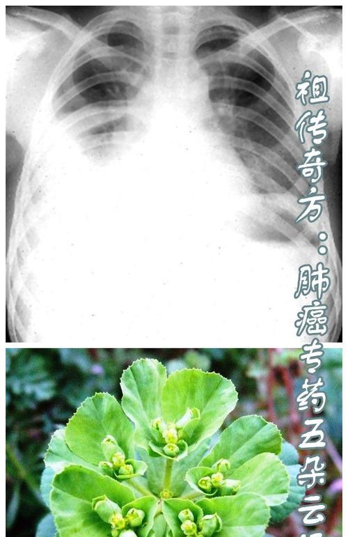 五朵云花语是什么意思？五朵云象征着什么？